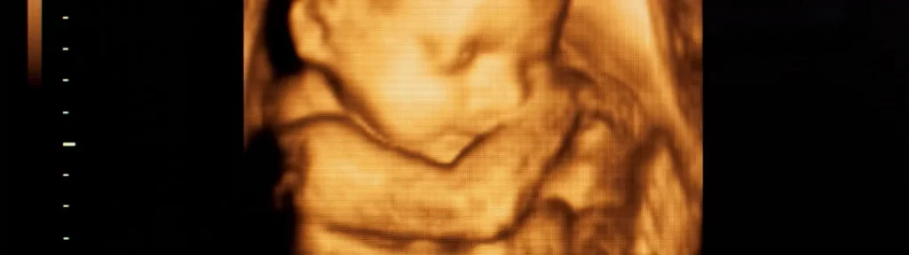 Imagem de resultado de exame de ultrassonografia 3D